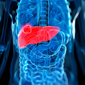 UTSW researchers develop blood test to predict liver cancer risk