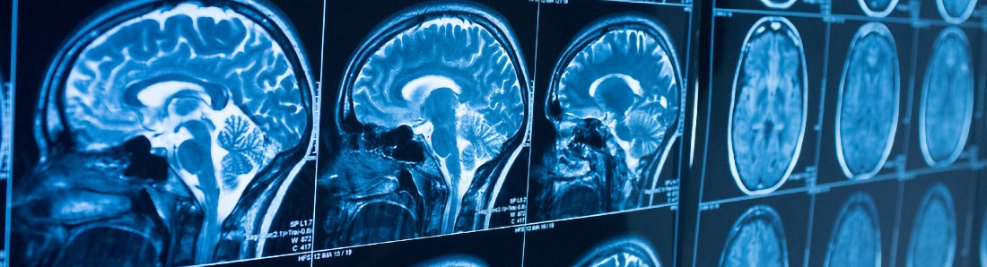neuro-1100x298.jpg