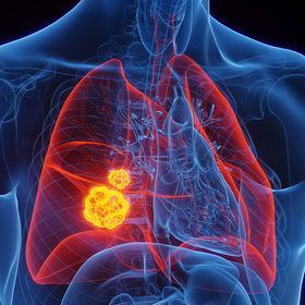 Antibody may improve treatment response in lung cancer