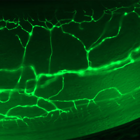 Protein coordinates responses to environmental stress