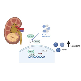 Kidney cancer drug shows promise against dangerous calcium imbalance caused by tumors