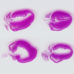 Disrupted metabolism linked to heart failure, UTSW study finds