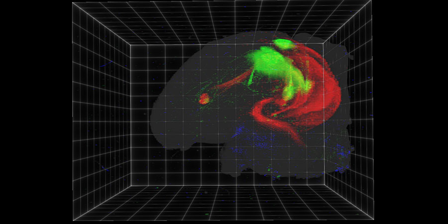 songbird brain