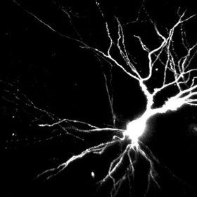 Dendrites may be key to learning and memory, study suggests