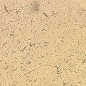 Presurgical vaccine may prevent orthopedic device infections