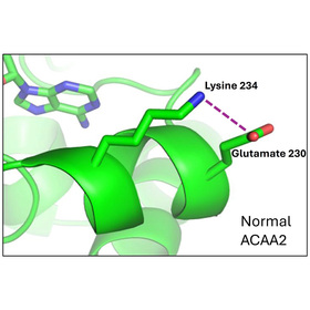 Rare genetic disorder linked to liver dysfunction, hypoglycemia, lipodystrophy