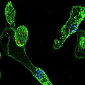 Protein linked to immune response against tuberculosis