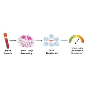 Simple blood test may predict abnormal bone growth early