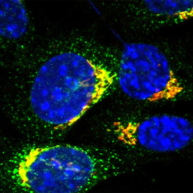 Study identifies transport protein key to immune response