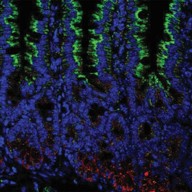Gut bacteria boost immune system, help send vitamin A to T cells