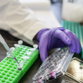 UT Southwestern ranked No. 1 in the world for healthcare research by <i>Nature Index</i>