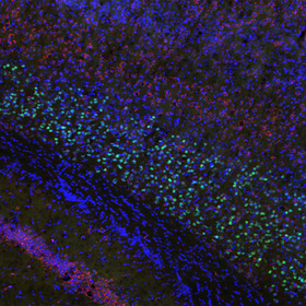 Unmasking autism spectrum disorder through its gene-based roots