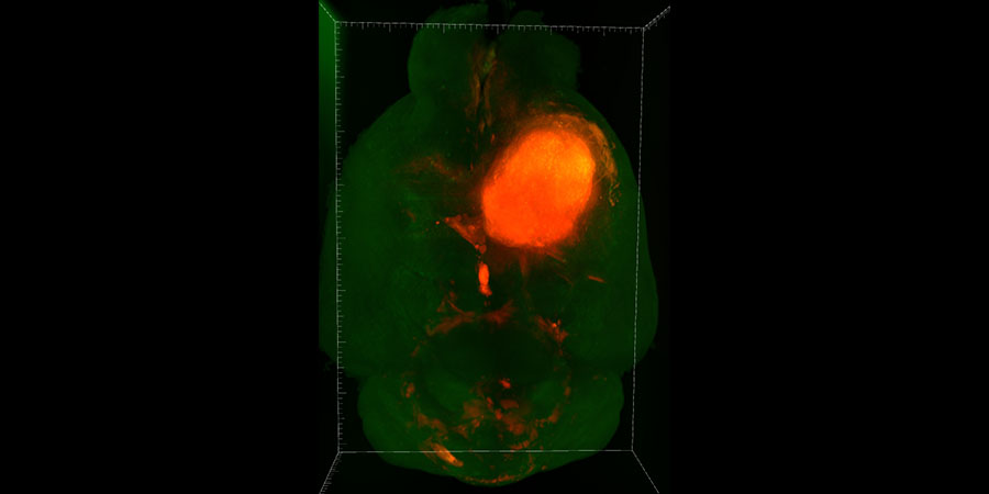 3D view of a tumor bearing whole mouse brain