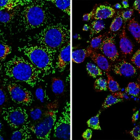 Stressors damage kidneys by mutating mitochondrial DNA