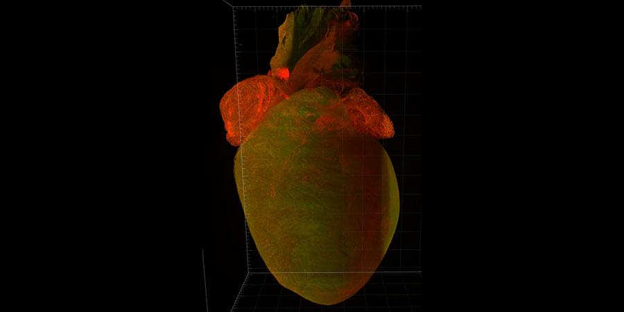 Mouse heart