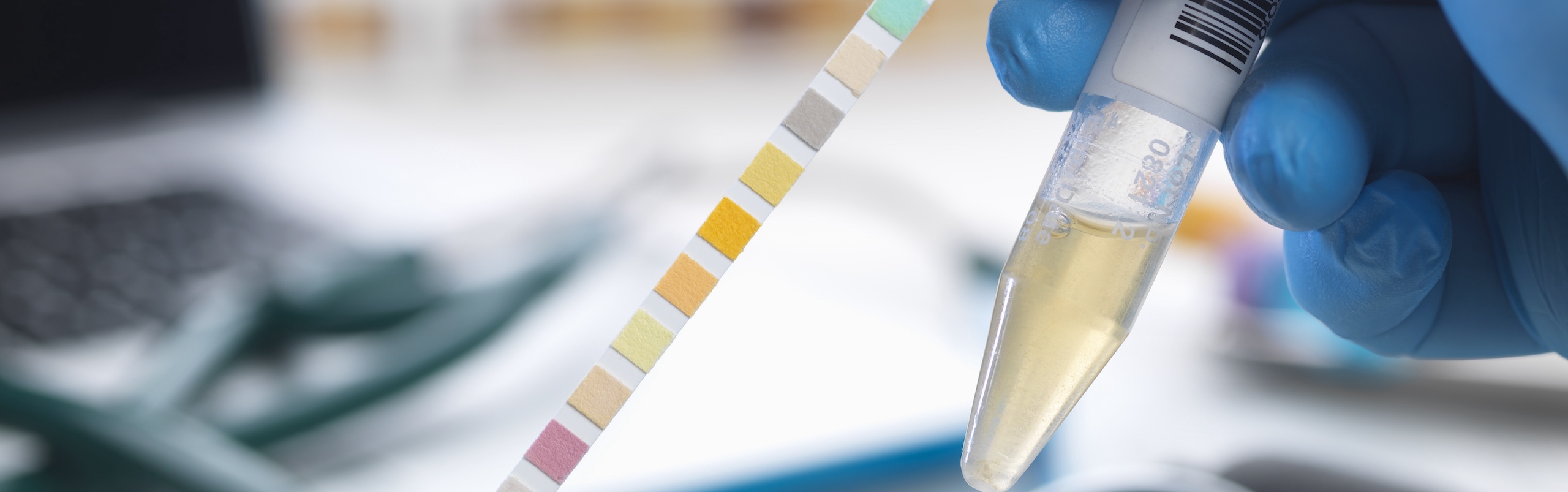 A dropper dropping a drop of liquid on a test strip.