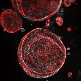 UTSW receives ARPA-H award to create functioning artificial liver