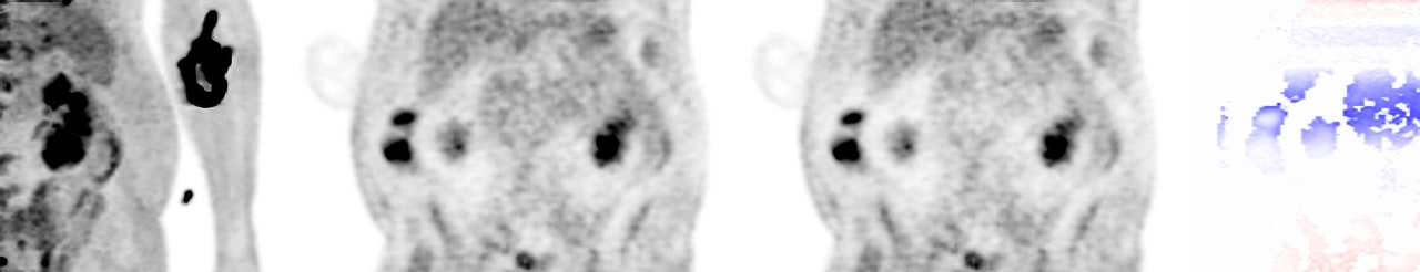 Imaging Metrics for Trials (IM4T)