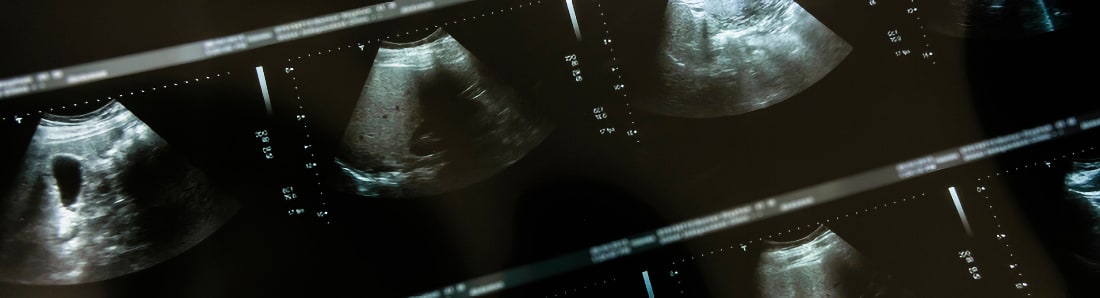 abdominal.jpg