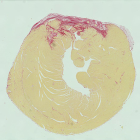 Gene editing halts damage in mice after heart attacks in UT&nbsp;Southwestern study