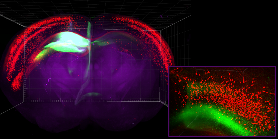 whole mouse brain & zoomed in section