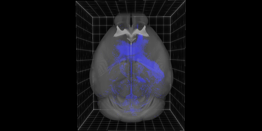 Dorsal view of a tumor-bearing mouse brain