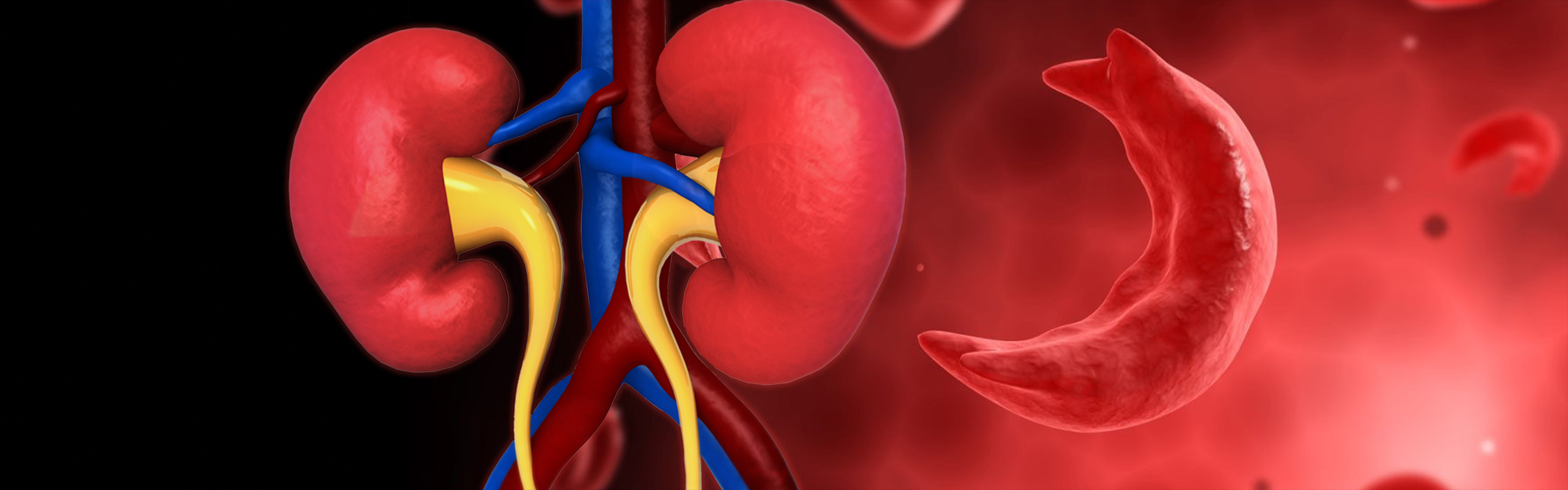 Sickle Cell Kidney (SCeK) Study Desktop Banner