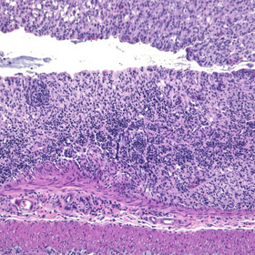 Protein puts brakes on intestinal inflammation, UTSW study finds