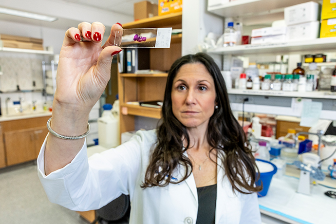 woman in white coat holds up microscope slide in lab