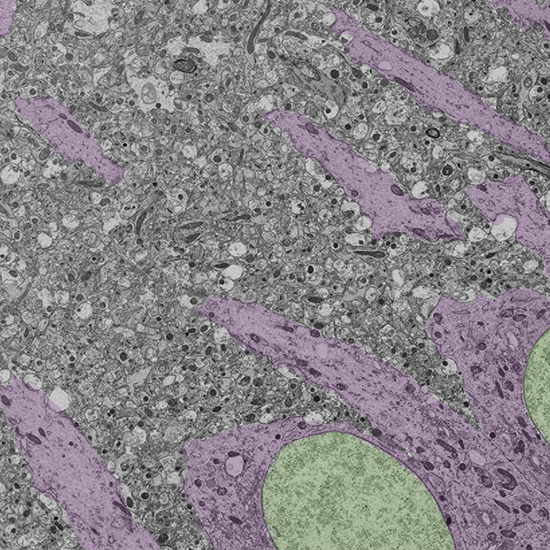 Gray, green, and purple microscope slide.