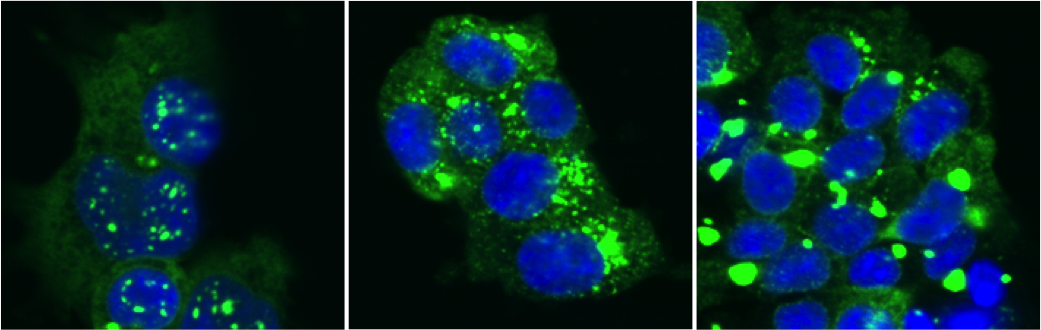 enlarged image of proteins