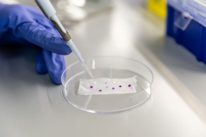 petri dish