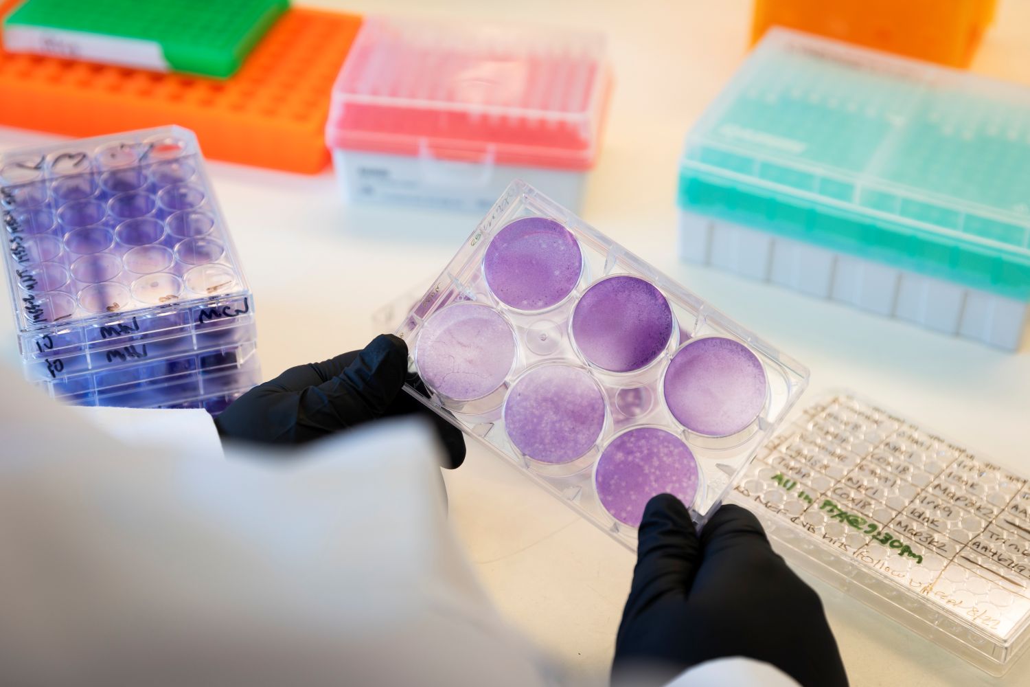 Plated agar dishes