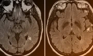 neuro-imaging-research-card