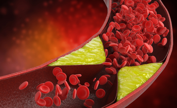 stroke-prevention-research