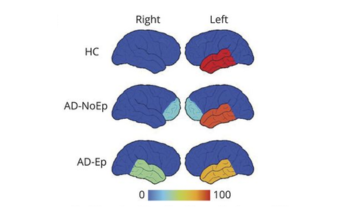 biomarkers