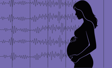 an illustration of a woman and a heart monitor