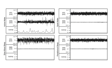 sleep & epilepsy
