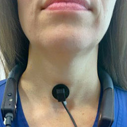 Voice Behavior & Rehabilitation Lab Research: How Everyday Voice Use and Personality Shape Phonotrauma Risk and Recovery