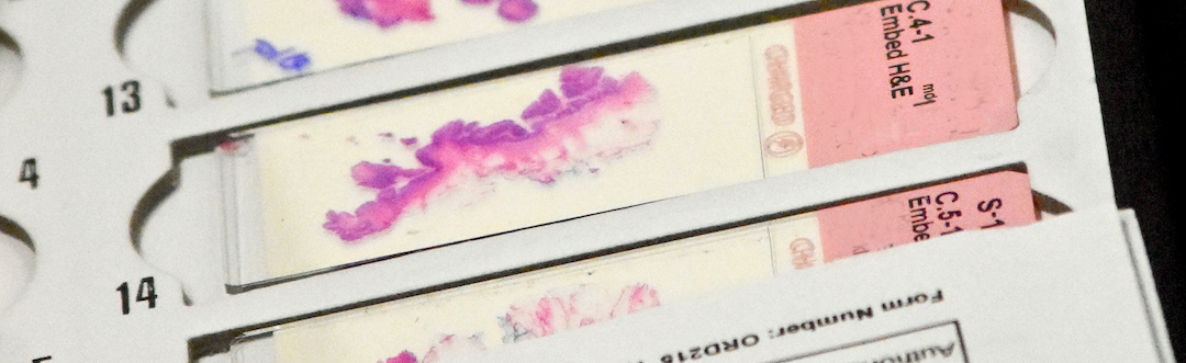 Patient Slide