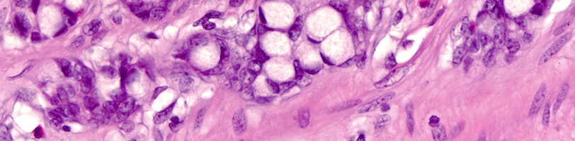 Microscopic view of a tissue sample
