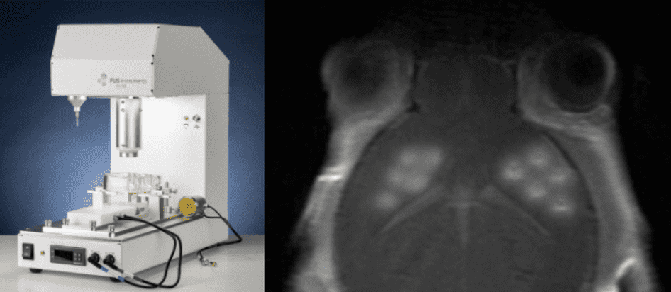 An image of the RK-50 focused ultrasound machine.