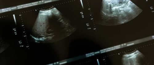 Abdominal Imaging