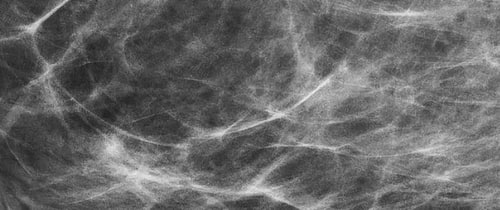 Breast Imaging