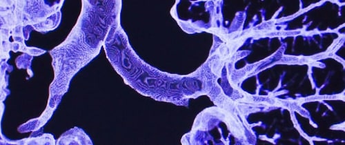 Cardiothoracic Imaging