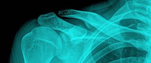 Community Radiology