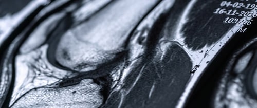 Musculoskeletal Radiology