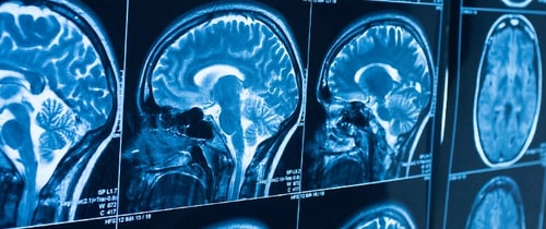 Neuroradiology