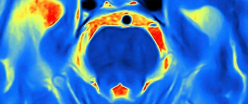 Nuclear Medicine