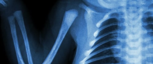 Pediatric Radiology